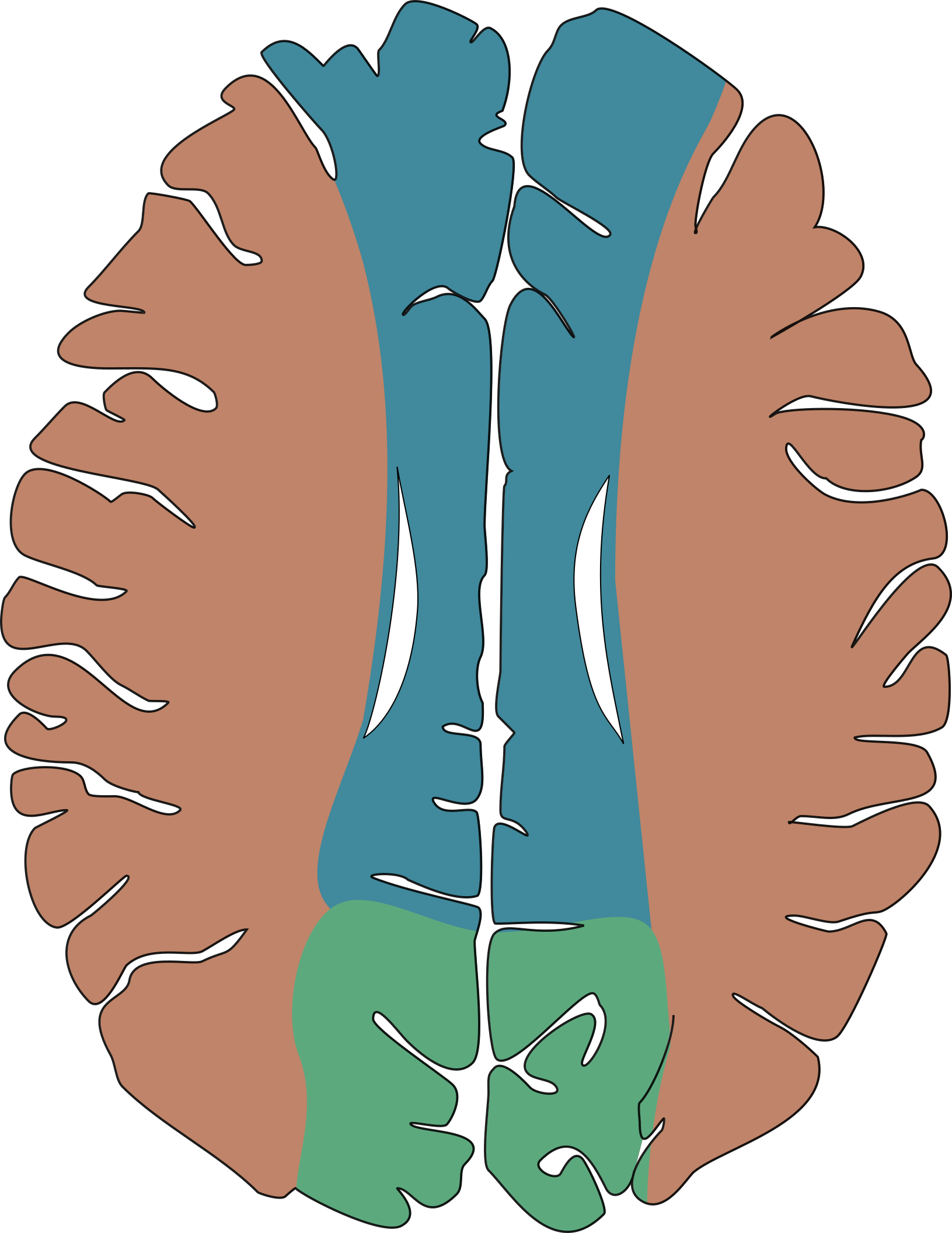 lateral-ventricles