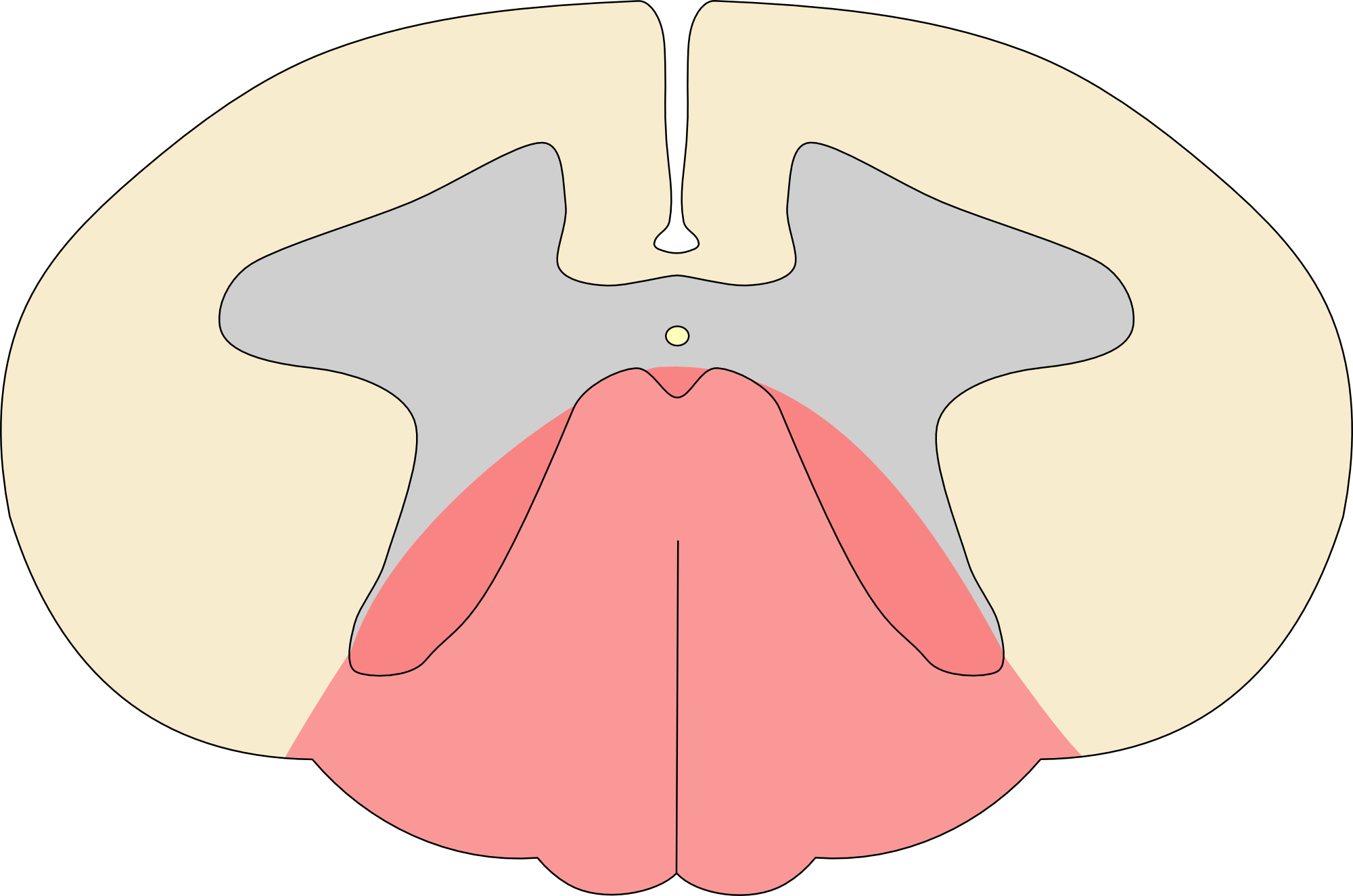 Posterior spinal cord syndrome